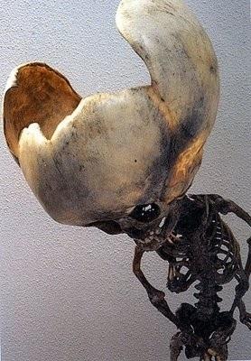 Medical Museum photo of infant skull. Courtesy photographer Rosamond Purcell