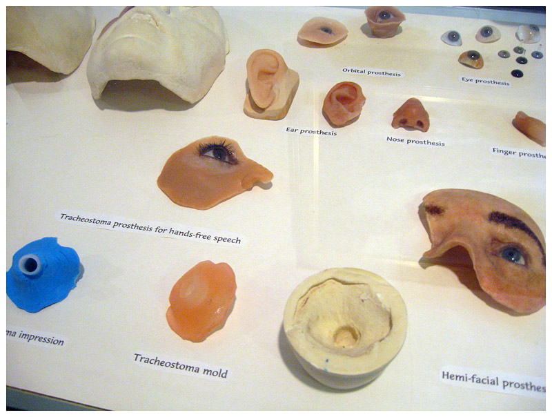 A display in the waiting room of the Boston Ocular Prosthetics office. (Photo by Ethan Andrews)