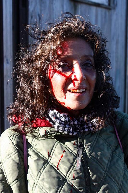 Waldo County Commissioner Amy Fowler, pictured with fake blood to simulate a head wound, was one of nine volunteers from Knox and Waldo counties participating in the mass casualty drill on Lasell Island Oct. 13. (Photo by Holly S. Edwards)