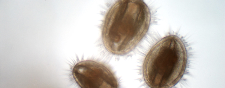 Oyster larvae. Courtesy of Mook Sea Farm