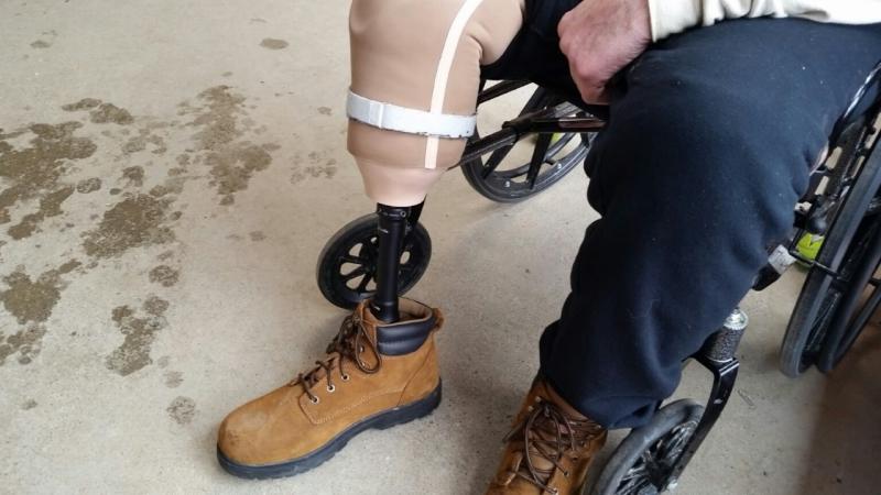 Stuart’s new prosthetic leg. (Photo by Sarah Shepherd)