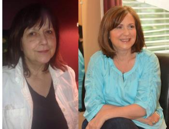The before photo, left, was taken by Hana, JoAnna Galkowski’s granddaughter, which she sent in to the contest. The after photo is courtesy Skin Klinic, at the conclusion of the final makeup session. The entire process took three months.