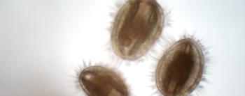 Oyster larvae. Courtesy of Mook Sea Farm