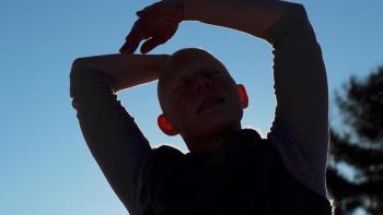 Ann Hedly Rousseau in a film still for the documentary Mop Cap: an Alopecia Story premiering at Maine International Film Festival Sunday, July 16.