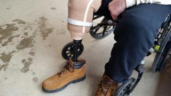 Stuart’s new prosthetic leg. (Photo by Sarah Shepherd)