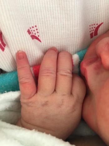 nora fingers