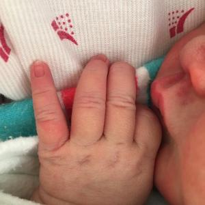 nora fingers